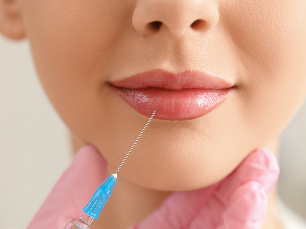 Dermal Fillers & Injectables - Who Should Perform Them? 
